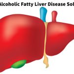 Non-Alcoholic Fatty Liver Disease Solution Review