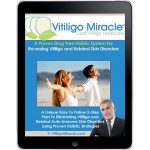 Vitiligo Miracle Review
