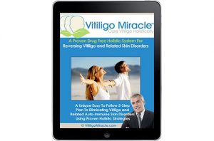 Vitiligo Miracle Review